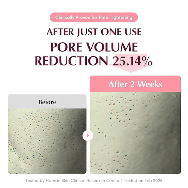 Eqqualberry Collagen Pore-Tight Up Mask Biome PDRN (Box 4 Masks)