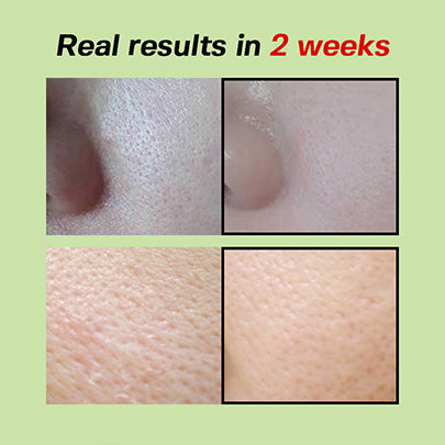 Sungboon Editor Green Tomato Pore Lifting Ampoule