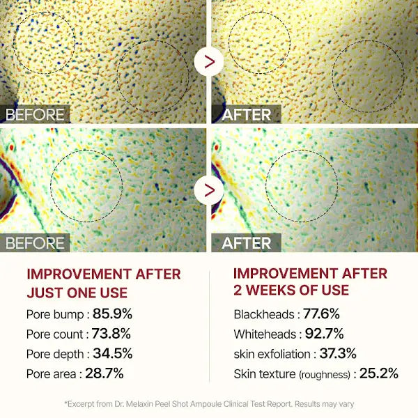 Dr.Melaxin Peel Shot Exfoliating Black Rice Ampoule – Blackheads & Pore Care (80ml)