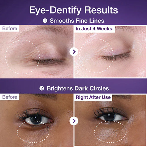 Numbuzin No.9 NAD+ Retinol Eye Cream