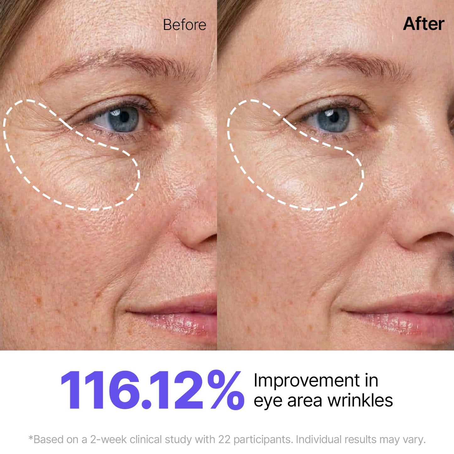 Sungboon Editor Silk Peptide EGF Gold Mask (1ea)