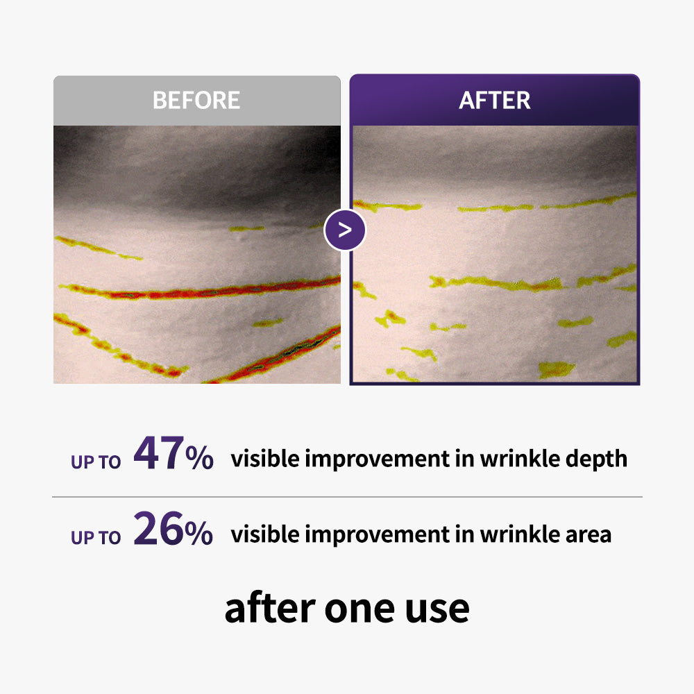 essl Retinal Age-Reset Neck Patch (3ea)