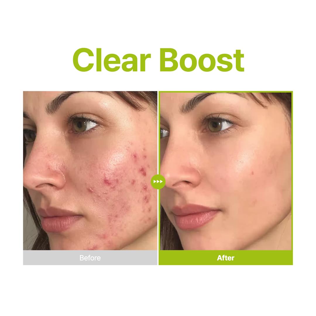 Purito Seoul Azelaic Acid 10 Kojic Azulene Serum 30ml