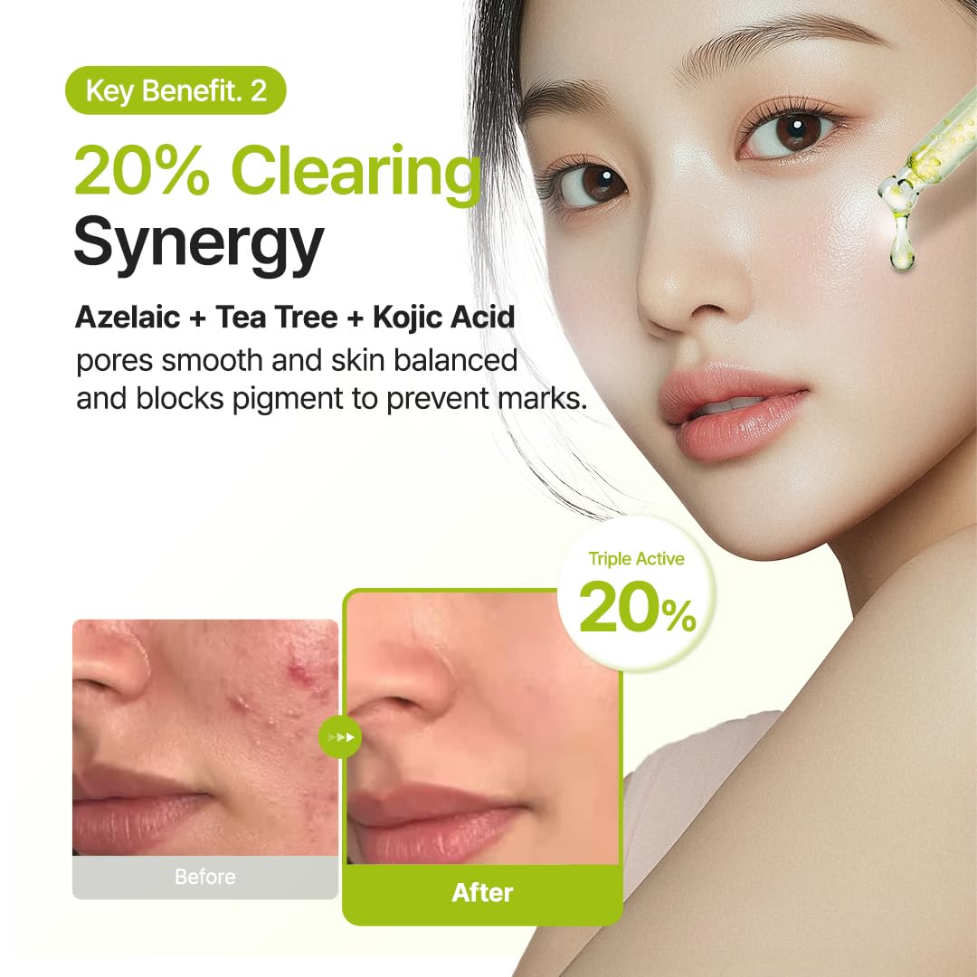 Purito Seoul Azelaic Acid 10 Kojic Azulene Serum 30ml