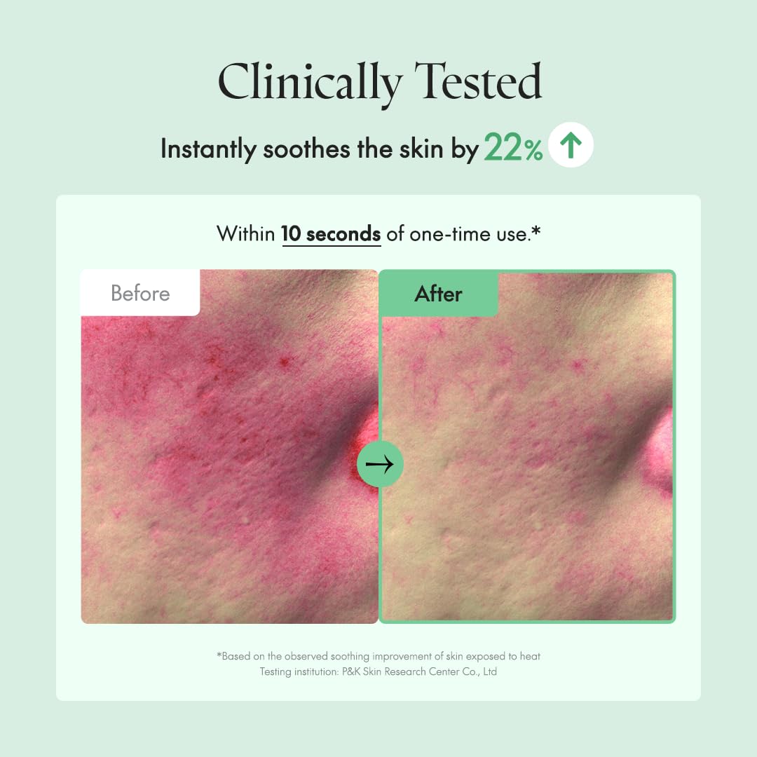 Purito Best Set for Redness, Rosacea & Inflammation Relief