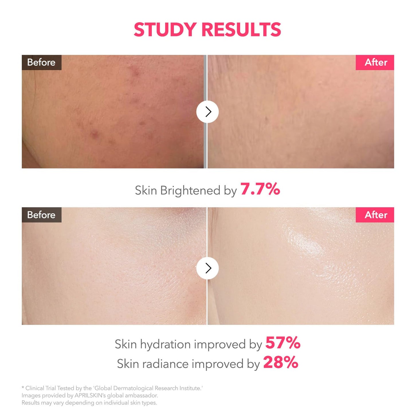 April Skin TXA Niacinamide Collagen 99 Capsule Gel Mask (4 Sheets)
