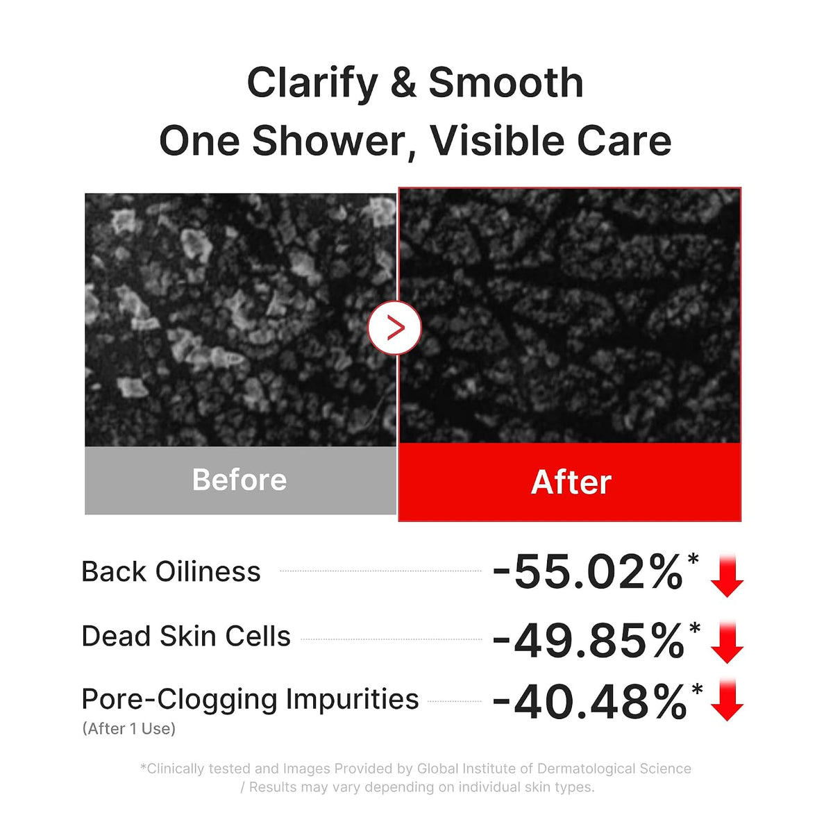 Medicube Red Acne Body Wash 3.0 *Renewed*