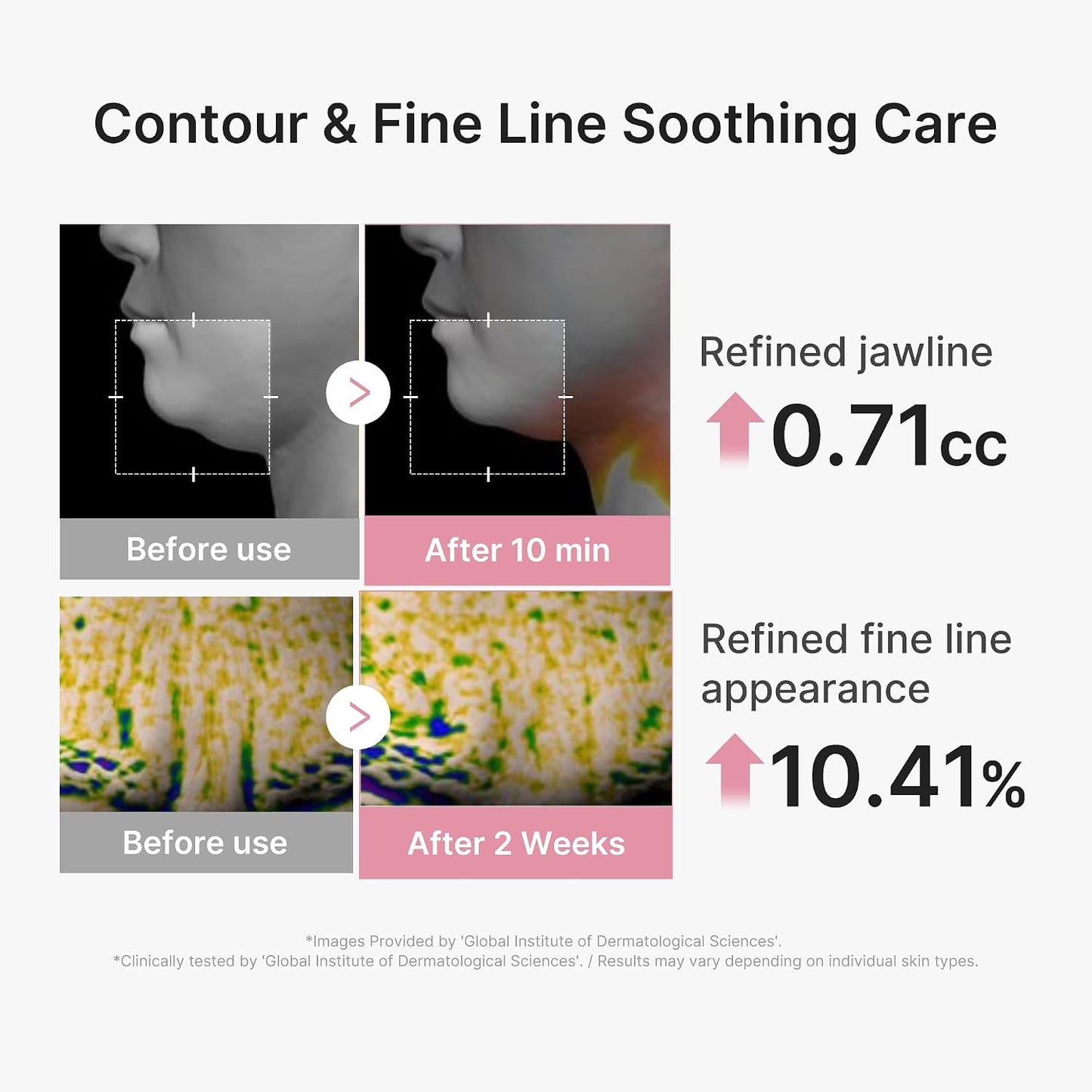 Medicube PDRN Pink Lift Up Mask (4 Sheets)