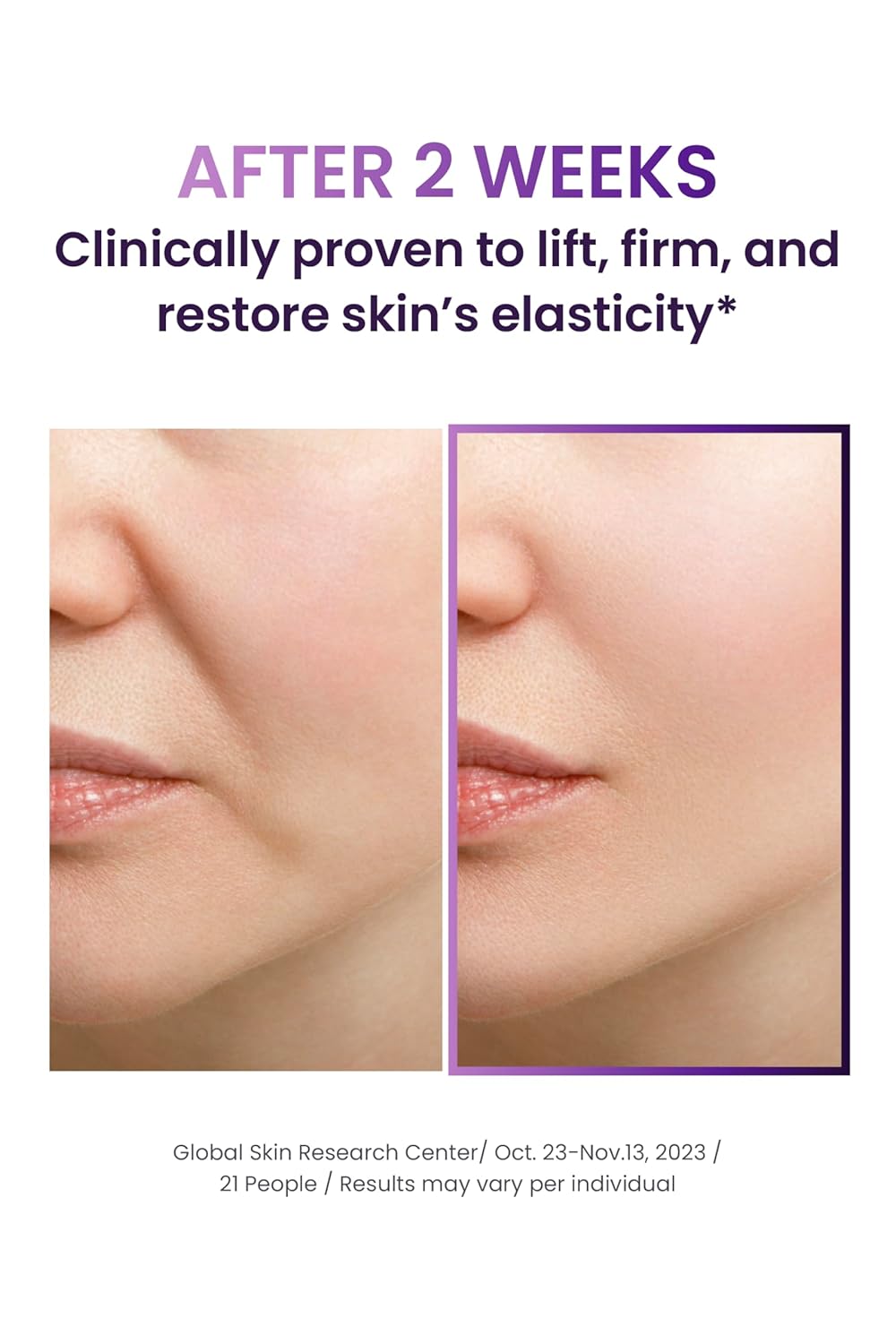 BIOHEAL BOH Probioderm™ 3D Lifting Cream 50 ml