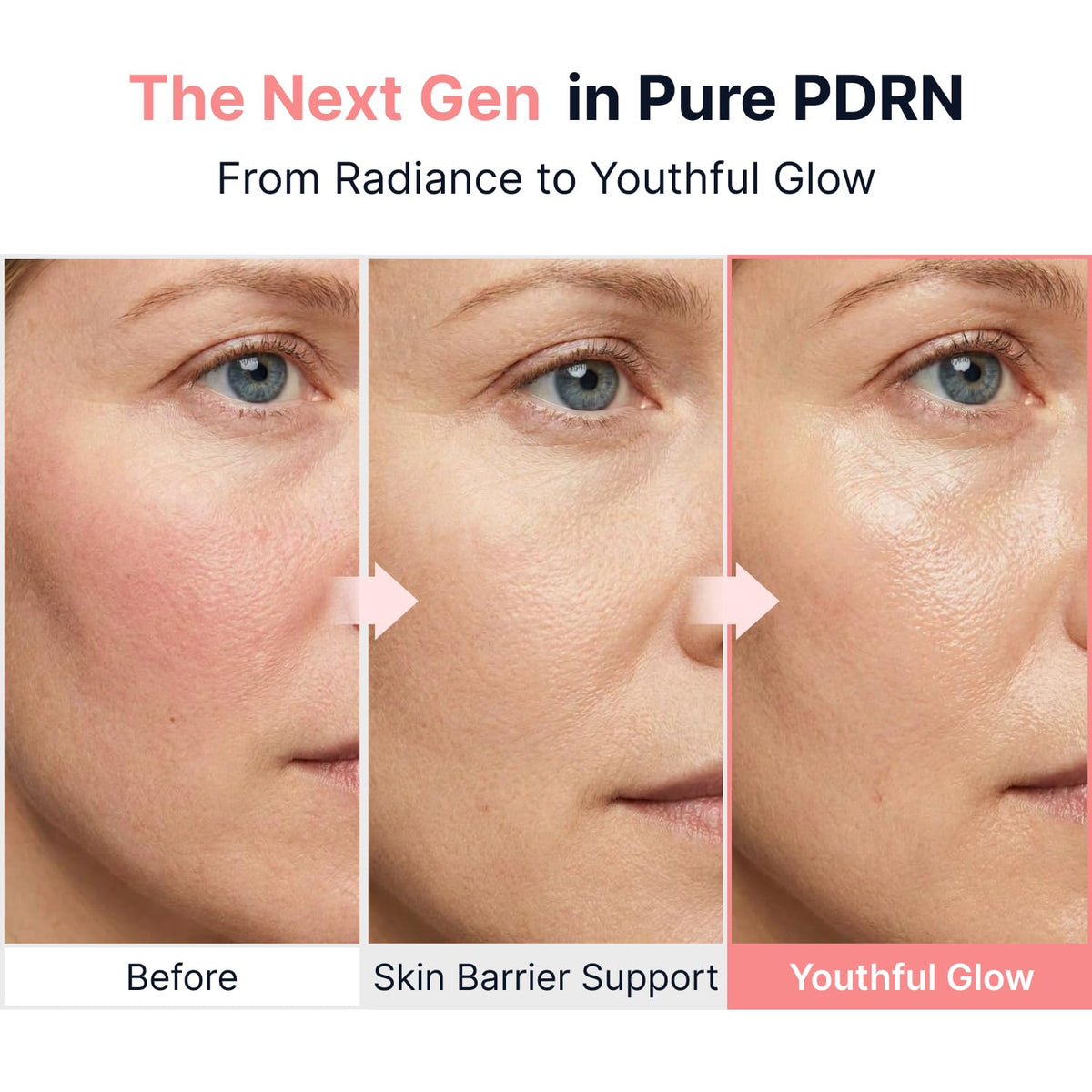 Sungboon Editor PDRN Pink Vitamin Glow Boosting Ampoule – 35ml