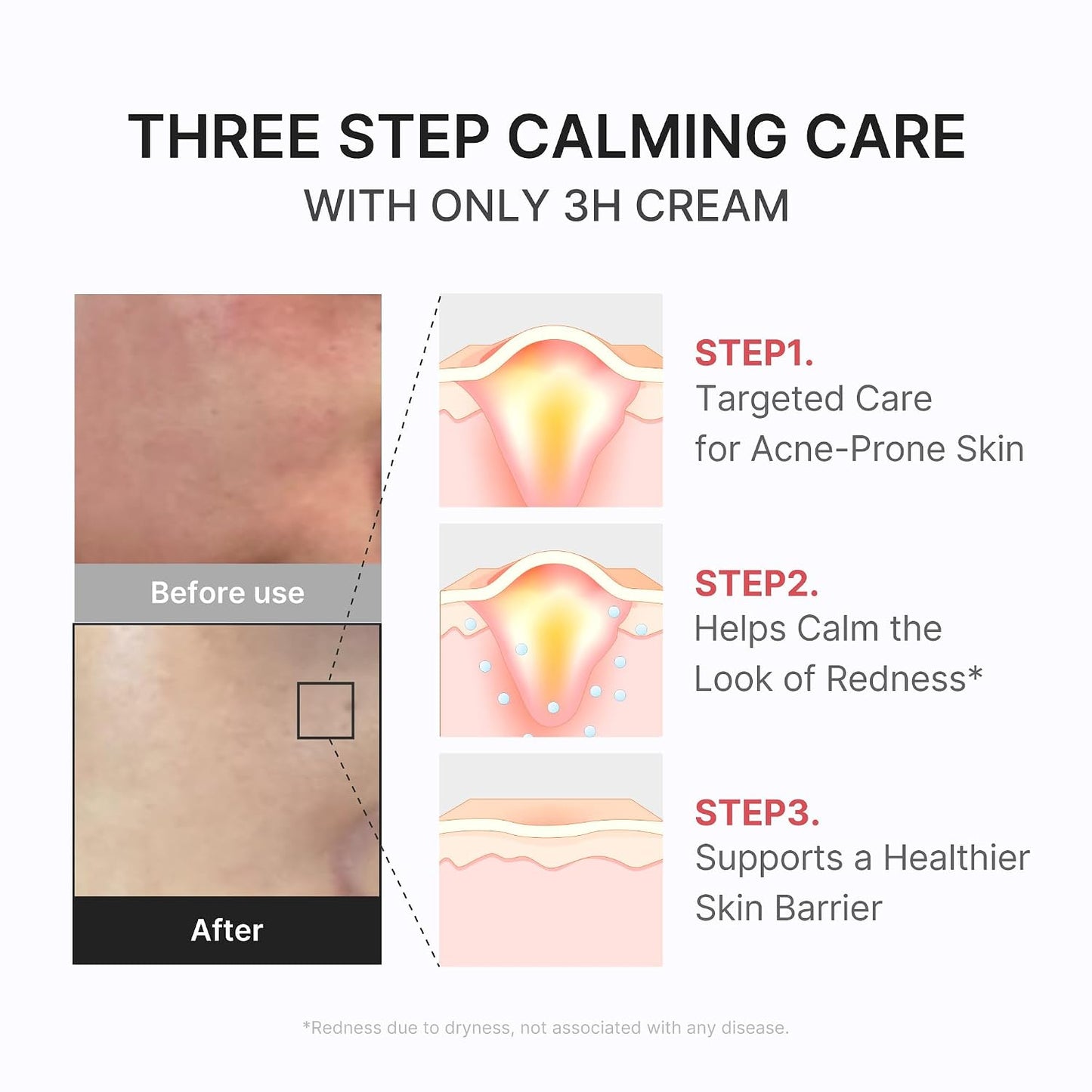 Medicube Hypochlorous 3H Relief Cream 50ml