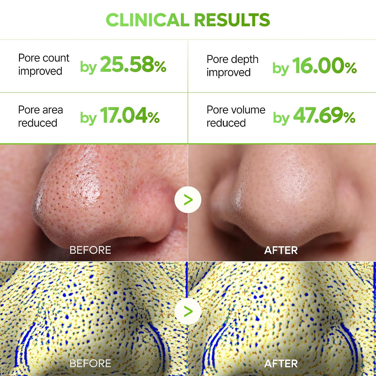 Dr. Melaxin CACTOX 3-Step Nose Pore Pack – 3ea