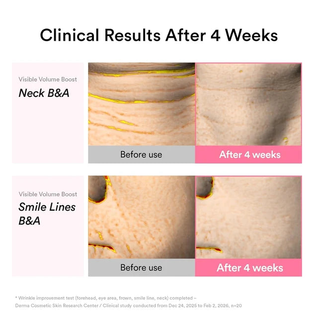 Abib PDRN VOLUME FILL-IT BOOSTER 2.5 — 30ml
