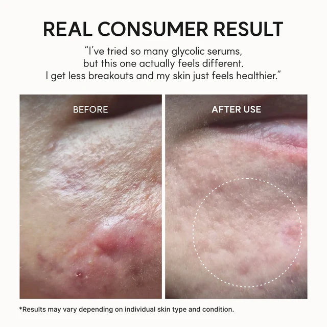 Arencia Eraser Shot Glycolic Acid Booster