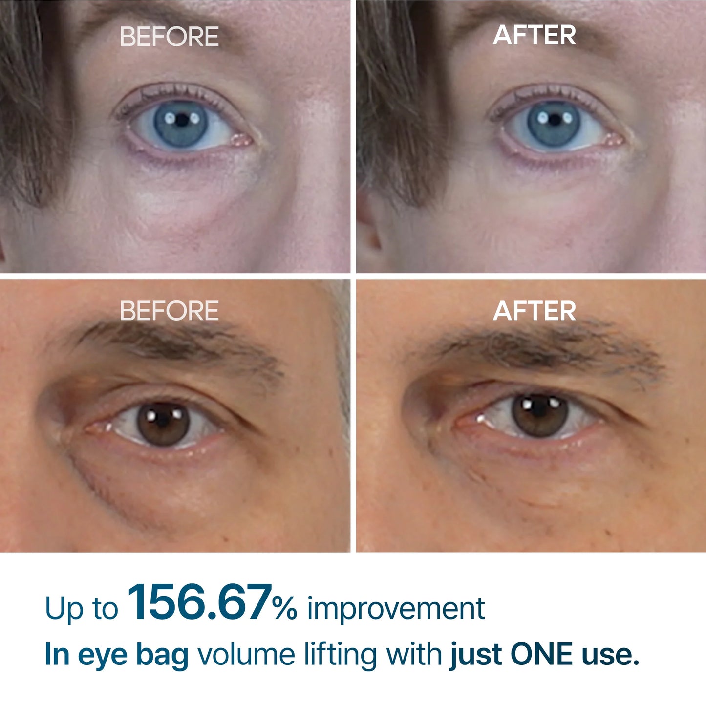 Dr. Melaxin Eyephalt Eye Cream for Eyebags (10ml)