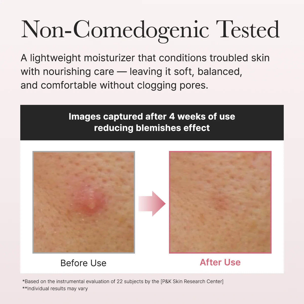 Arencia Red Smoothie Face Lotion Moisturizer 5% Niacinamide & Collagen