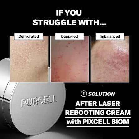 Purcell Pixcell Biom After Laser Rebooting Cream (50ml)