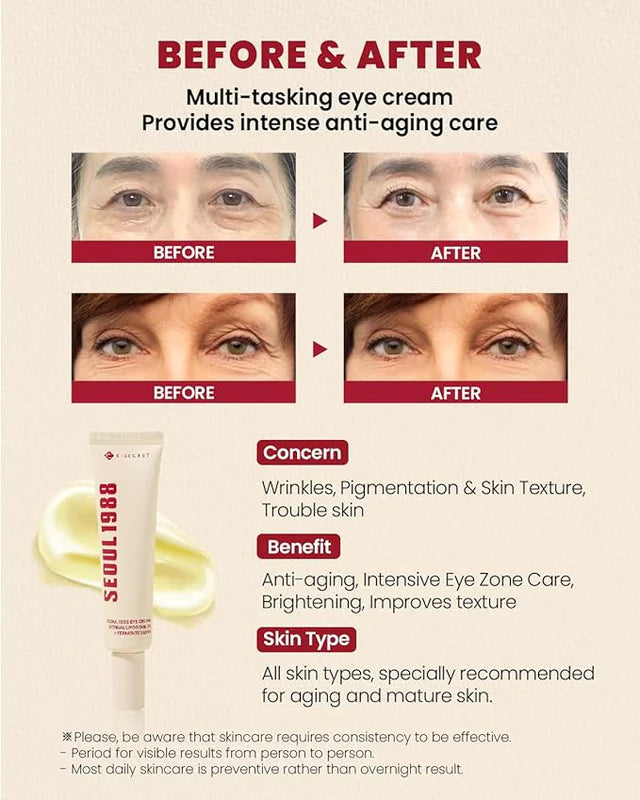 KSecret SEOUL 1988 Eye Cream – Retinal Liposome 4% + Fermented Extracts (30mL)