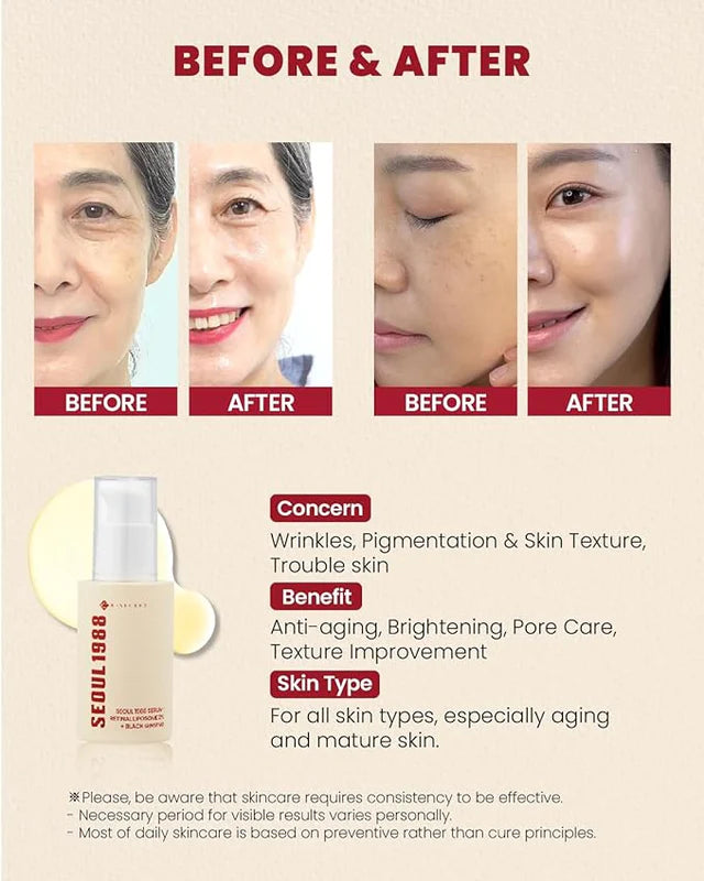 KSecret SEOUL 1988 Serum – Retinal Liposome 2% + Black Ginseng (30mL)