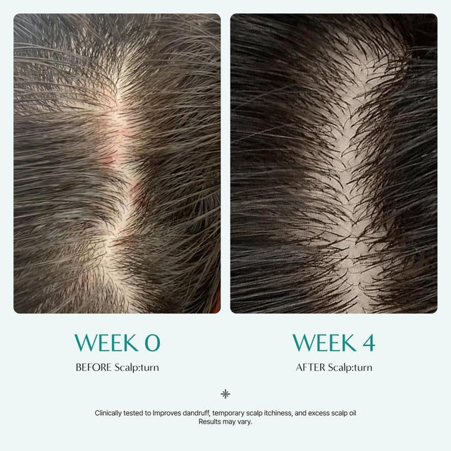 Lilyeve Scalp Turn Cica PDRN Brush Ampoule Mini 30ml