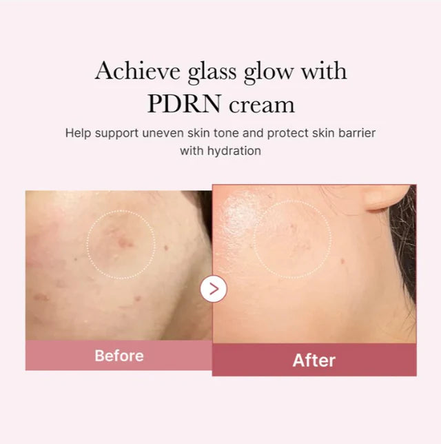 Medicube PDRN Pink Hyaluronic Moisturizing Cream (50ml)