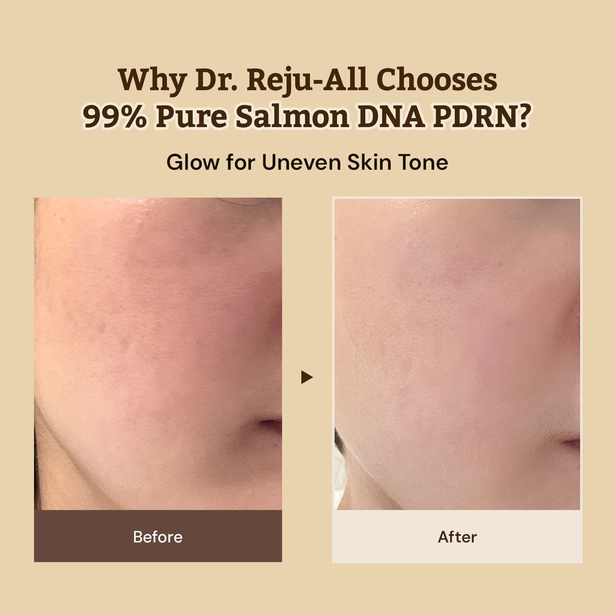 Dr. Reju-All Advanced PDRN Rejuvenating Cream – 20ml