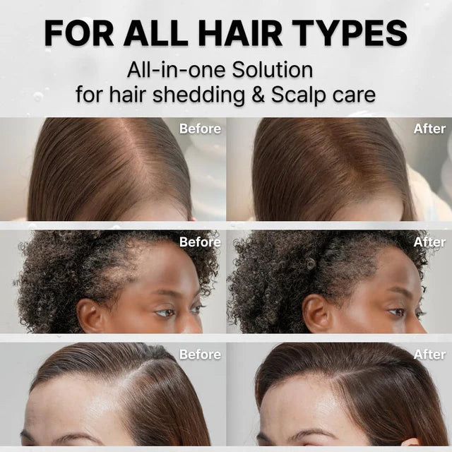 lilyeve Grow Turn Ampoule 100ml